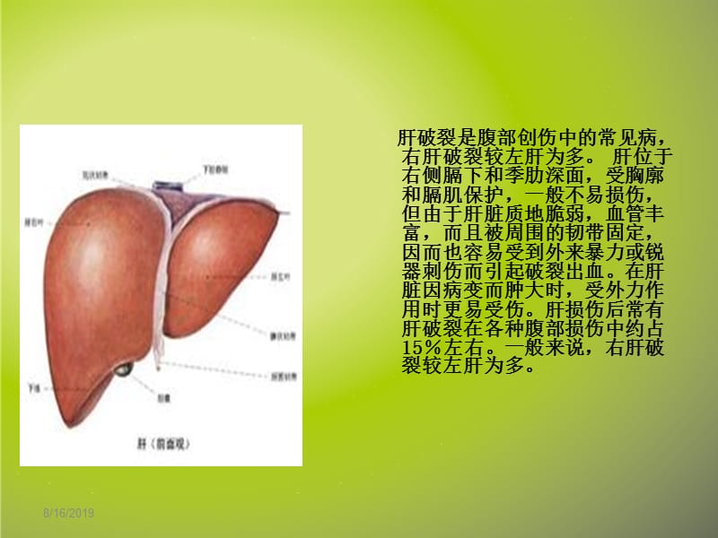 清爽绿色模版(4：3)-肝破裂的抢救与配合.ppt_第3页