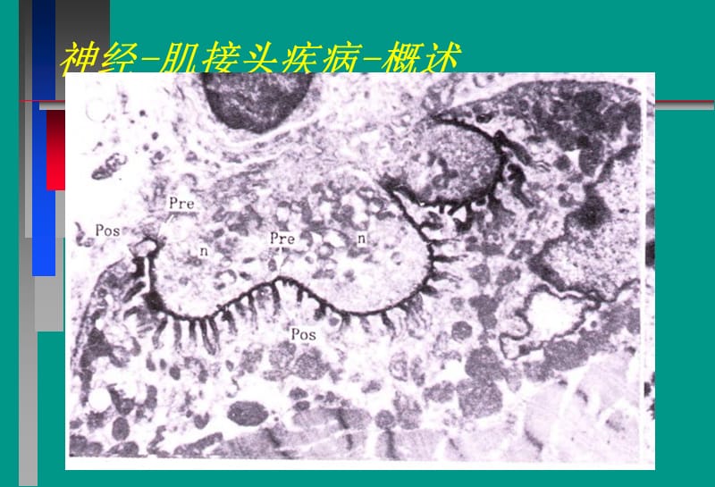 神经病学教学课件-重症肌无力中文.ppt_第2页