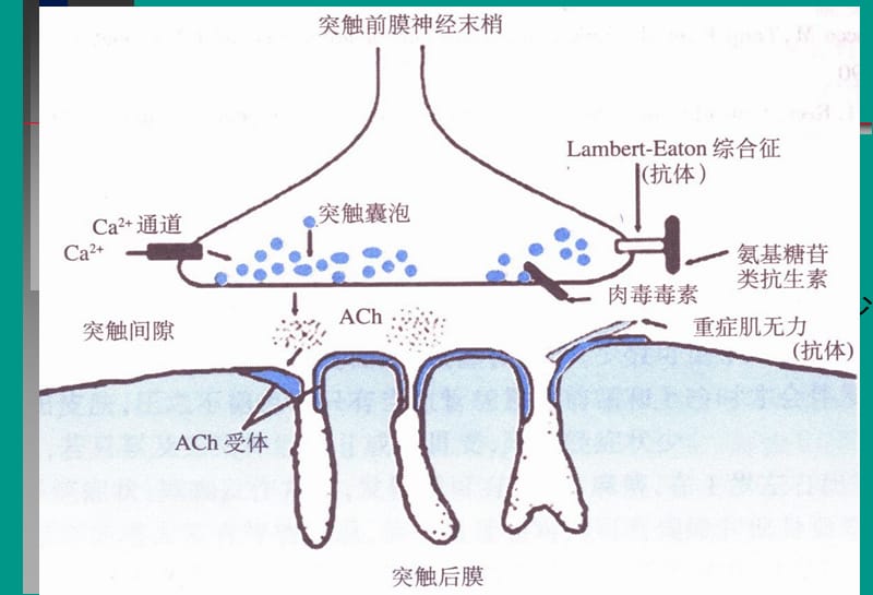 神经病学教学课件-重症肌无力中文.ppt_第3页