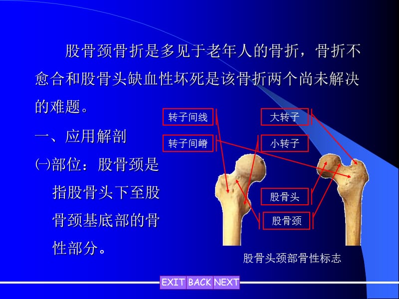 股骨颈骨折3页PPT课件ppt课件.ppt_第3页