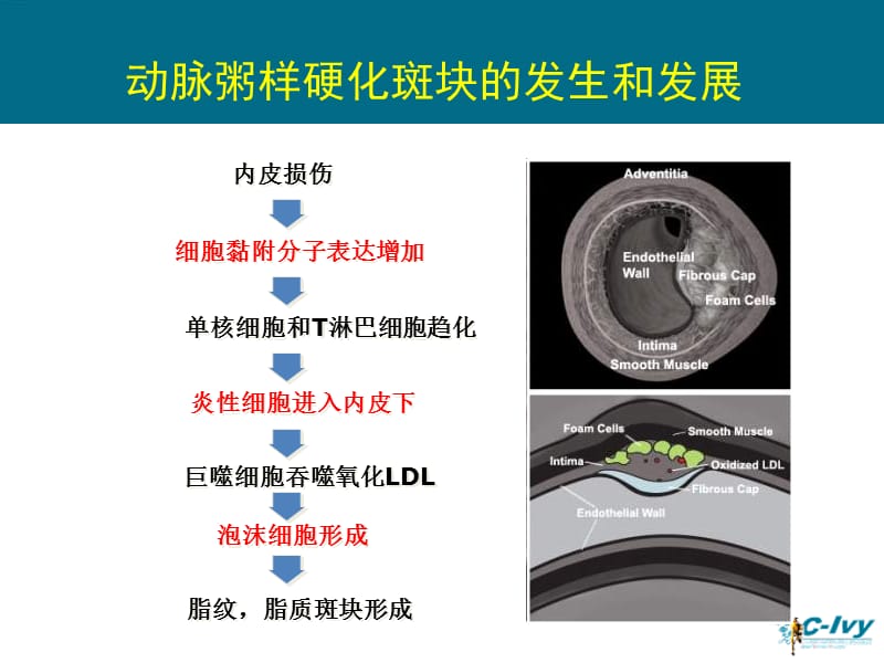 非PCI冠心病患者的他汀治疗教学课件.ppt_第2页