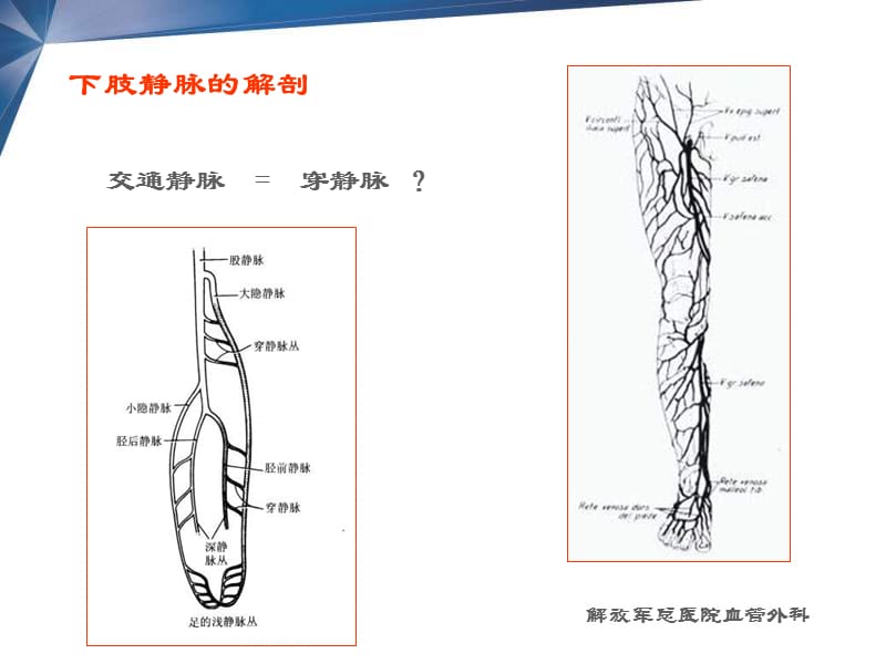 穿静脉在下肢静脉曲张中的作用.ppt_第3页