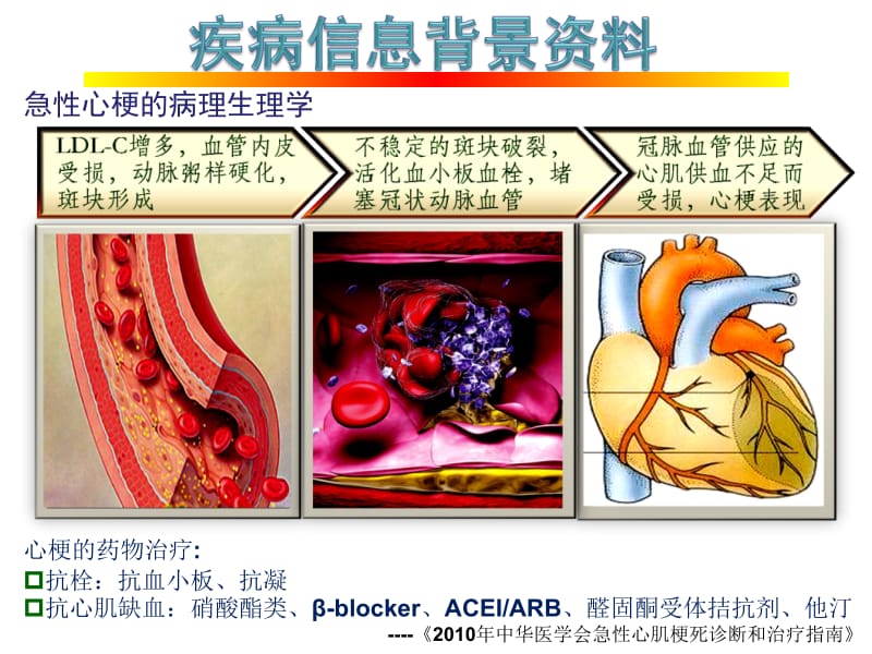 病例分析2-心梗伴代谢综合症.ppt_第2页