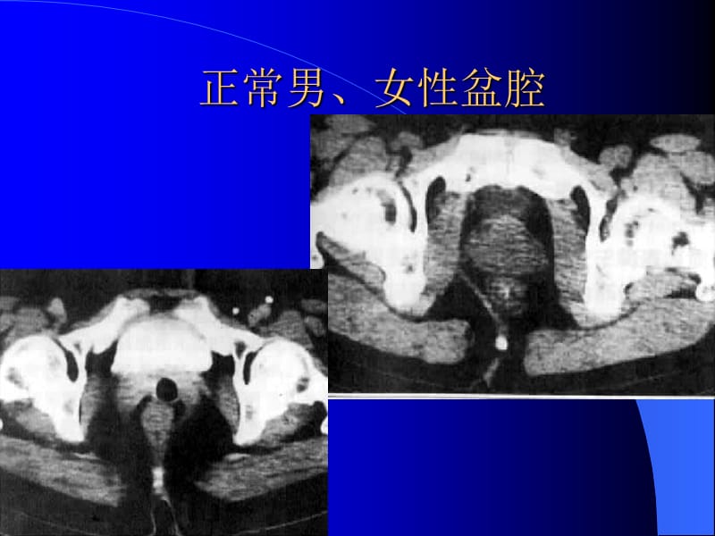 腹腔及腹膜后CT诊断2.ppt_第2页