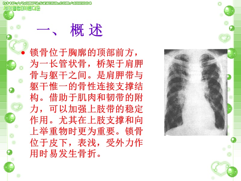 锁 骨 骨 折.ppt.ppt_第3页