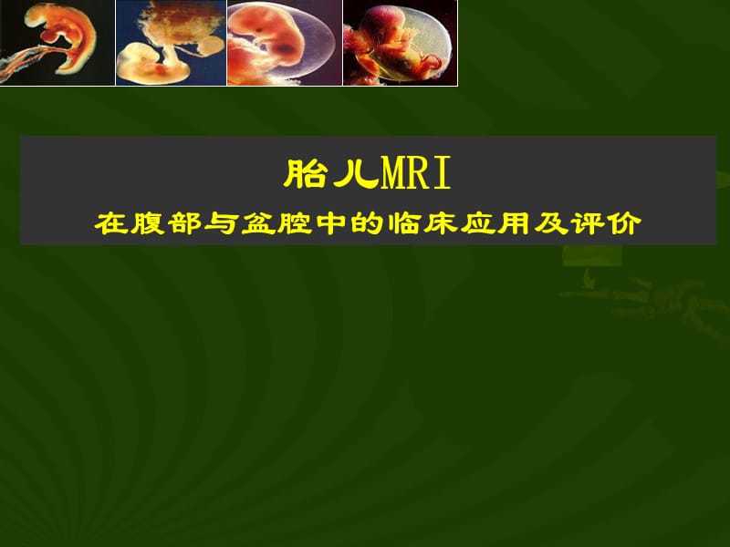 胎儿腹部MRI在腹部与盆腔中的临床应用及评价.ppt_第1页