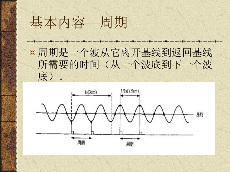 脑电图的临床应用.ppt_第3页