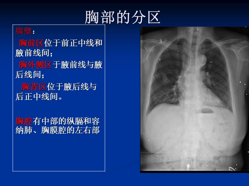 胸部局部解剖.ppt_第3页