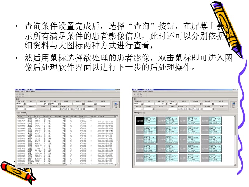 第章医学图像后处理技术ppt课件.ppt_第3页