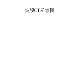 颅脑CT示意图.ppt