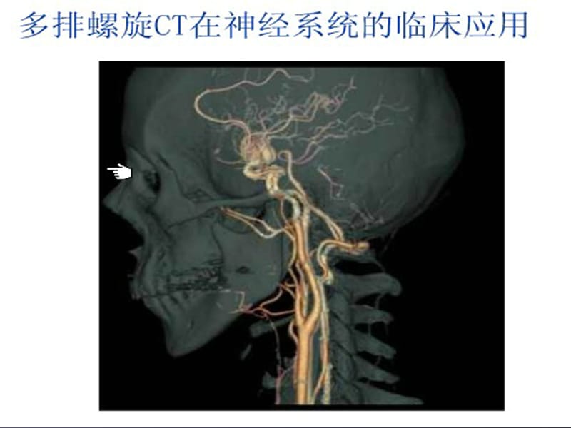 神经内科交流学习课件.ppt_第1页