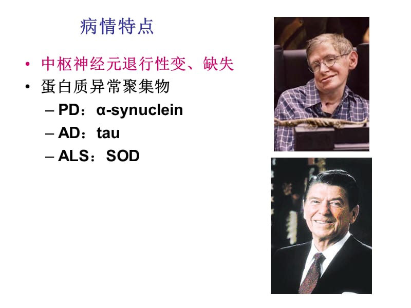 神经退行性疾病的特点.ppt_第3页