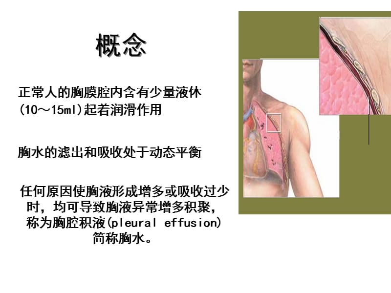 胸腔积液护理___.ppt_第2页