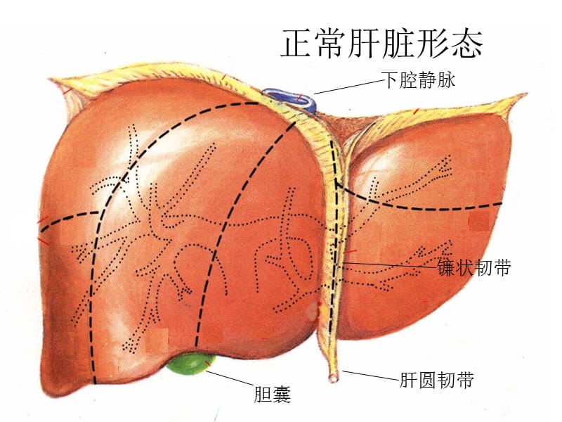 肝胆影像学诊断.ppt_第2页