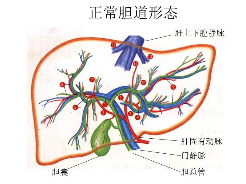 肝胆影像学诊断.ppt_第3页