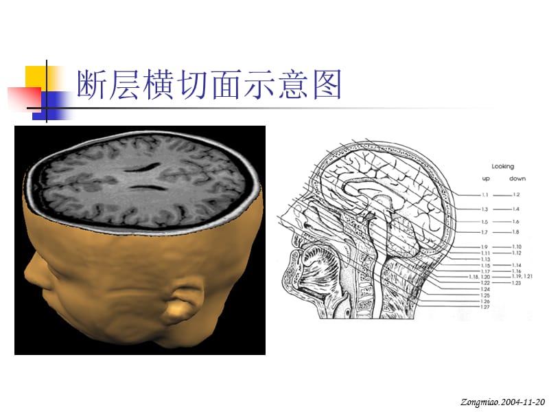 脑磁共振局部解剖与功能图谱(2).ppt_第3页