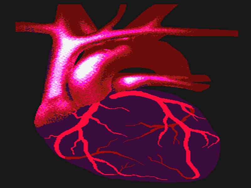 认识冠心病.ppt_第3页