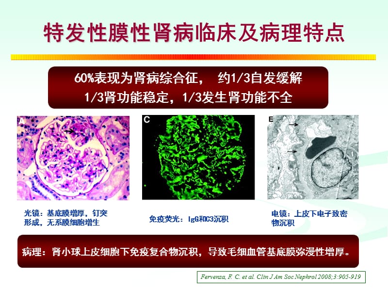 陈江华-膜性肾病治疗策略.ppt_第2页