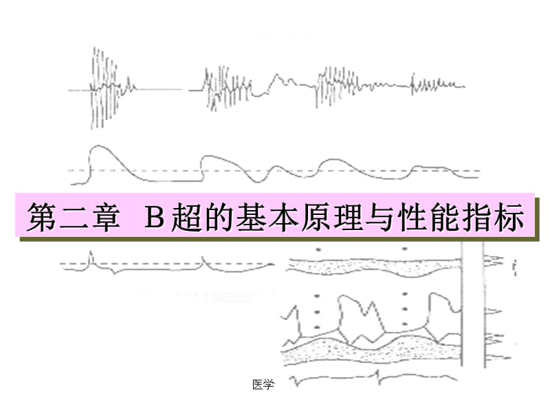 B超的基本原理与性能指标PPT课件.ppt_第1页