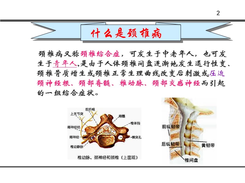 办公室人员如何防止颈椎病.ppt_第2页