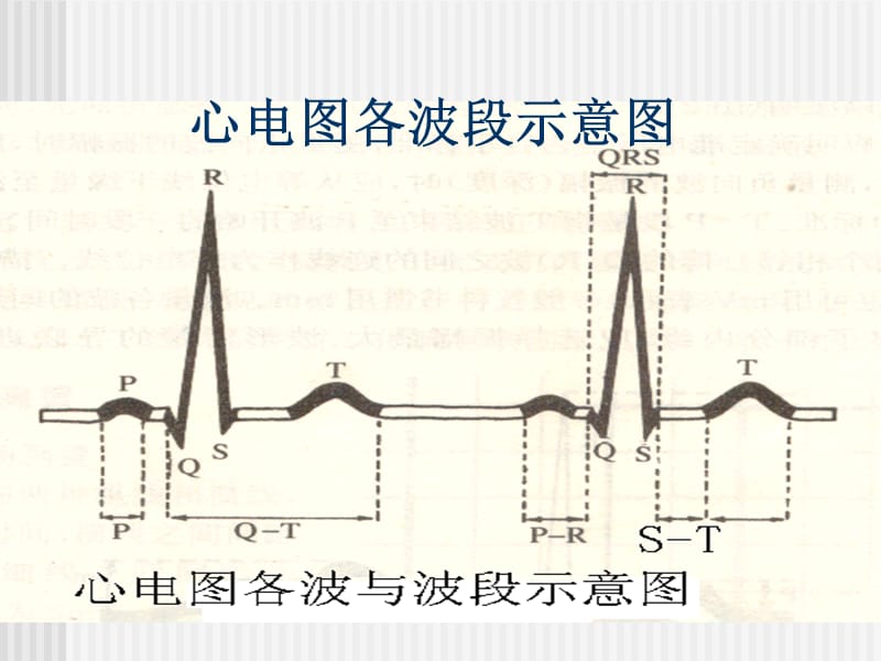 执业医师实践技能考试心电图培训.ppt_第2页