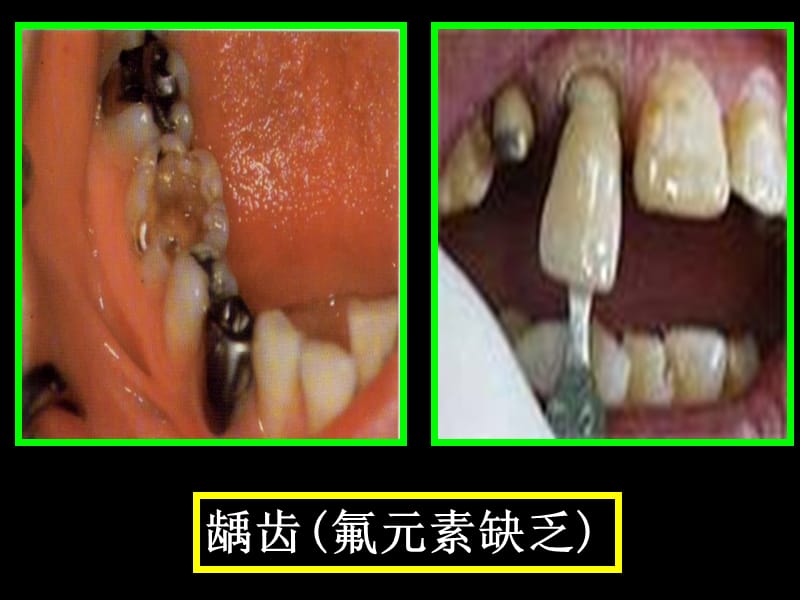 人教版初中化学《化学元素与人体健康》课件2.ppt_第3页