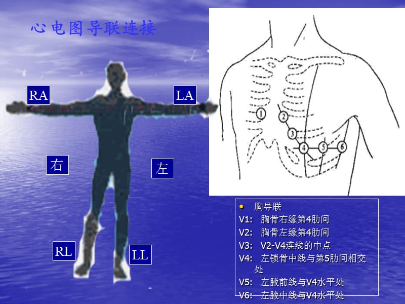 临床心电图教学.ppt_第3页