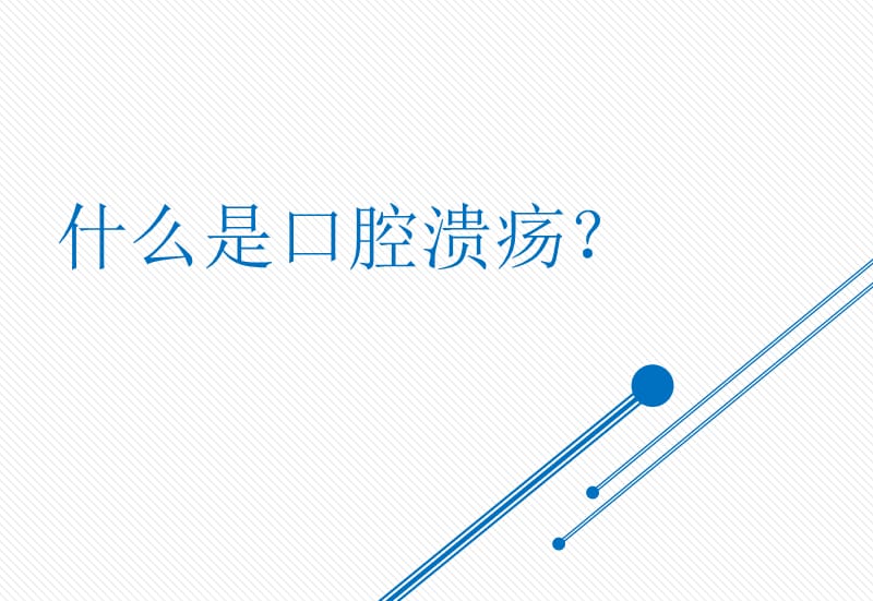 治疗口腔溃疡产品公关策划方案.ppt_第2页