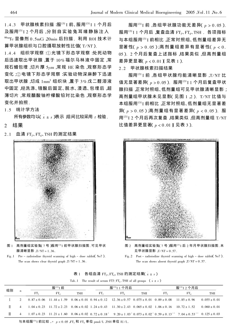 131I致兔甲状腺功能低下模型制作的探讨.pdf_第2页