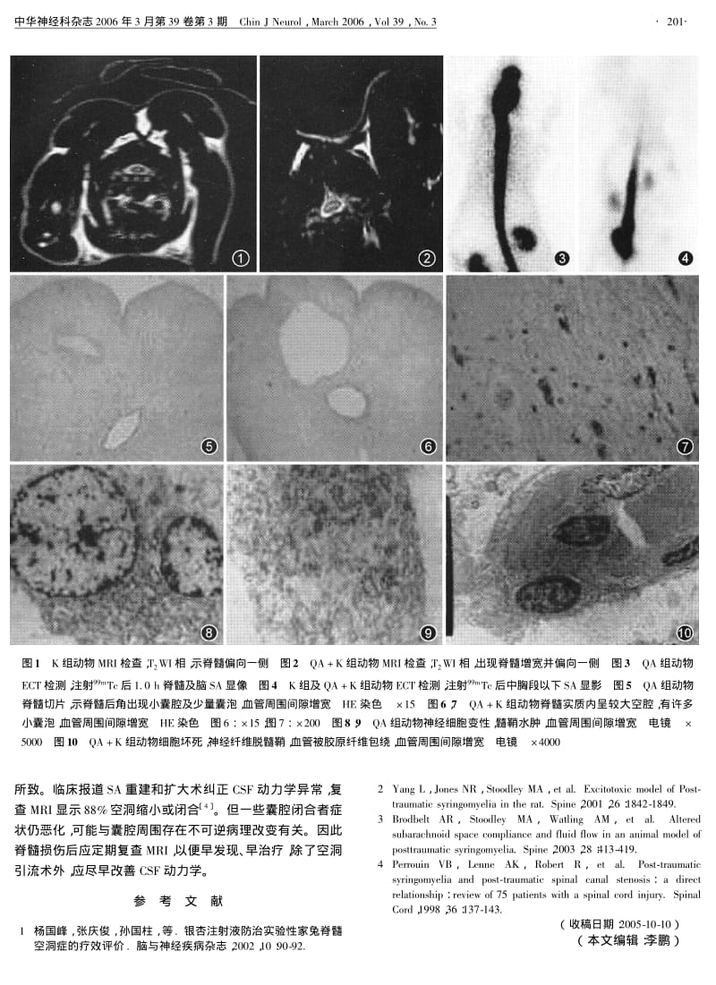 使君子氨酸致家兔创伤后脊髓空洞症发病机制的实验研究.pdf_第2页