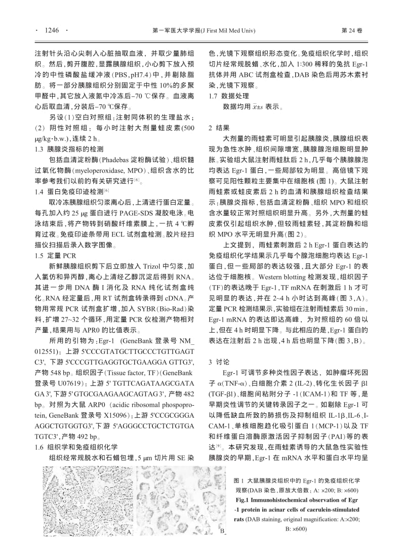 早期生长反应因子-1和组织因子在大鼠胰腺炎组织中的表达.pdf_第2页