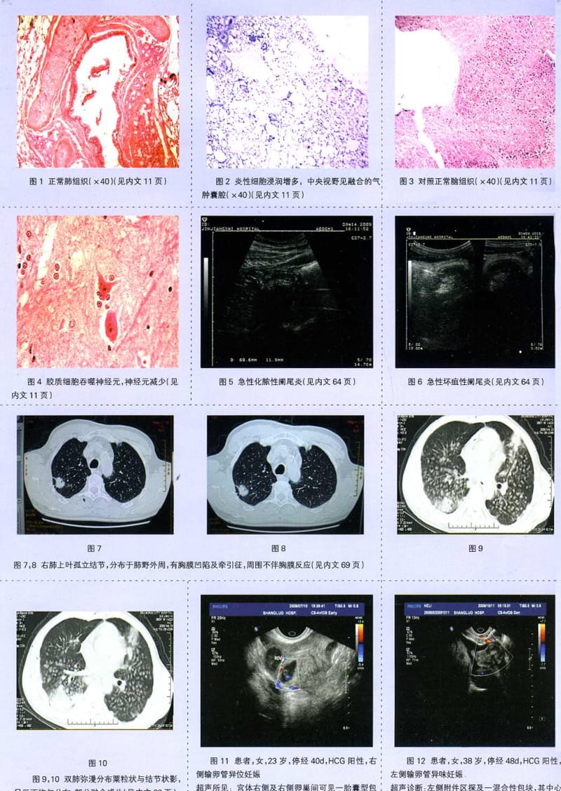 煤工尘肺大鼠模型对认知功能及脑细胞超微结构影响研究.pdf_第3页