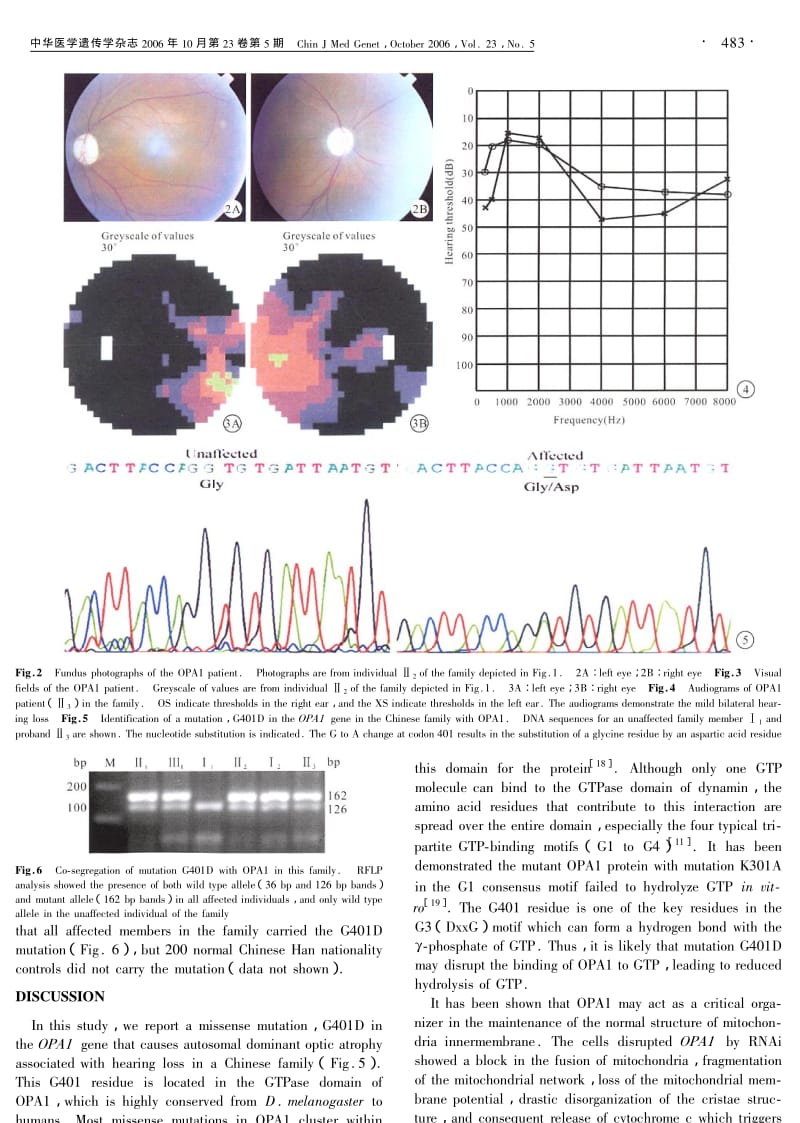 OPA1基因G401D突变导致常染色体视神经萎缩和听力受损.pdf_第3页