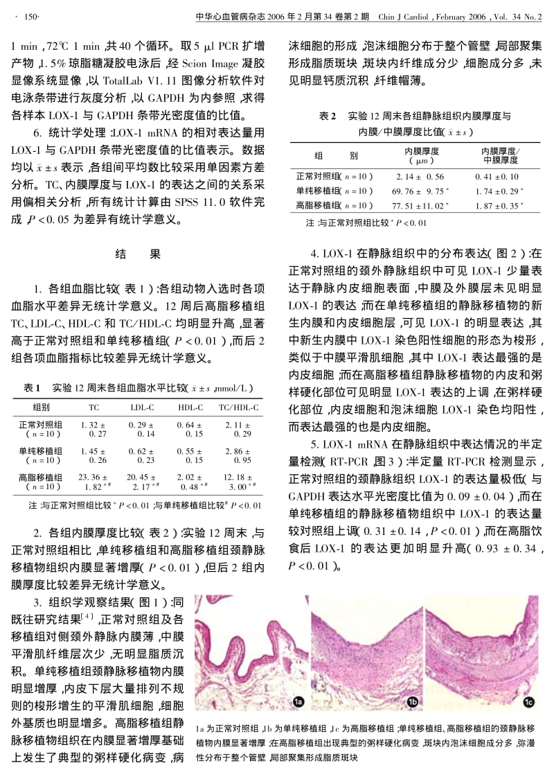 凝集素样氧化低密度脂蛋白受体1在兔自体静脉移植物及其粥样硬化病变中的分布表达.pdf_第3页