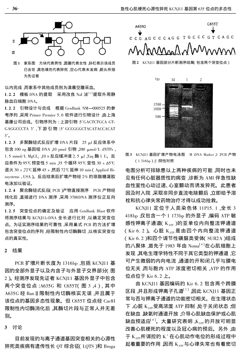 急性心肌梗死心源性猝死KCNJ11基因第635位点的多态性.pdf_第2页