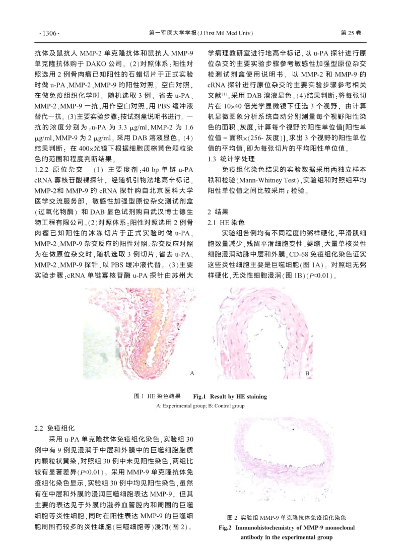 尿激酶型纤溶酶原活化物和基质金属蛋白酶类在腹主动脉瘤组织中的表达.pdf_第2页