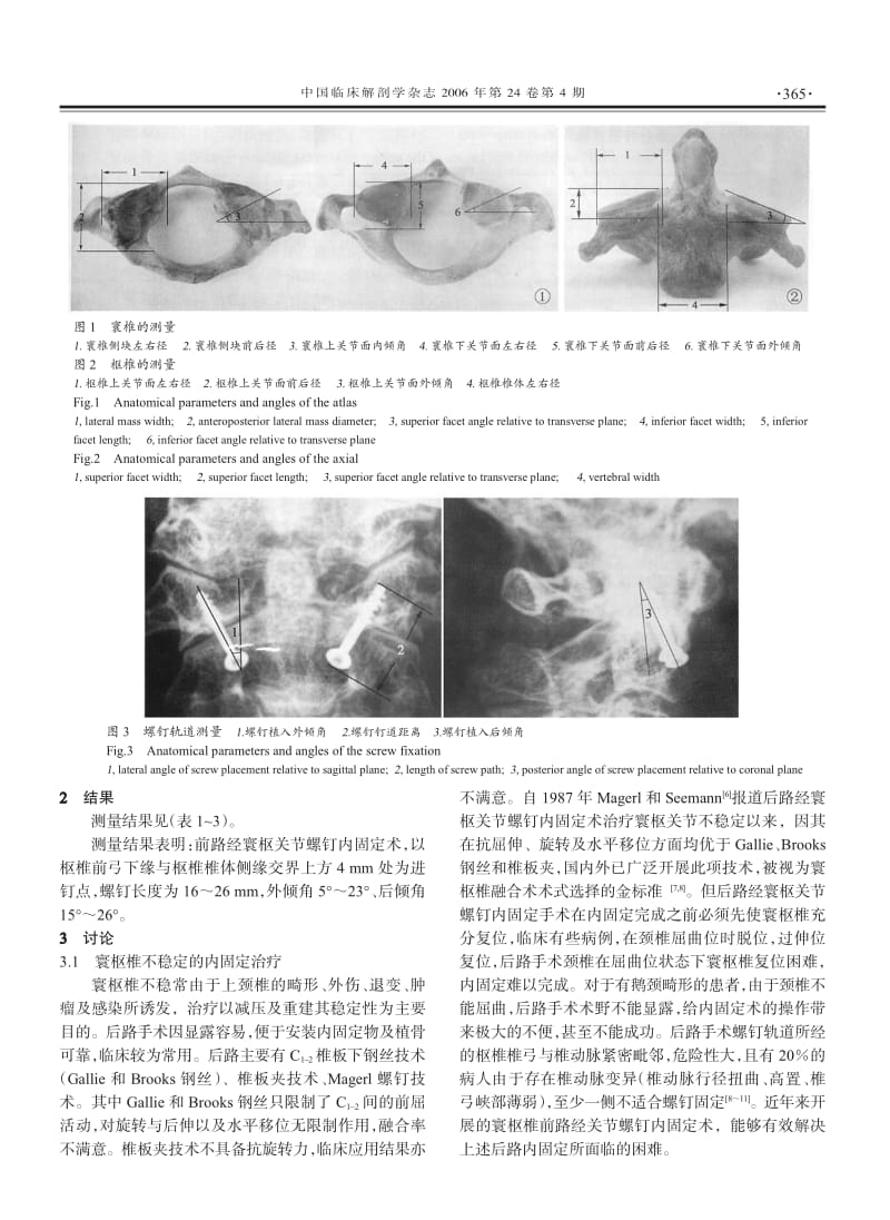 前路经寰枢关节螺钉内固定术的临床解剖学研究.pdf_第2页