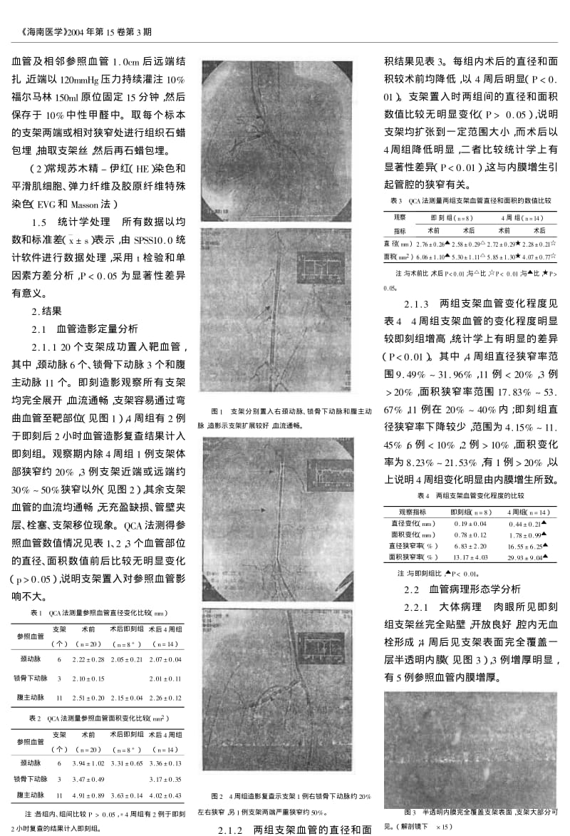 大连DW冠状动脉支架的动物实验研究.pdf_第3页