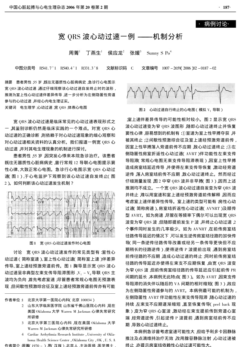 宽QRS波心动过速一例 机制分析.pdf_第1页