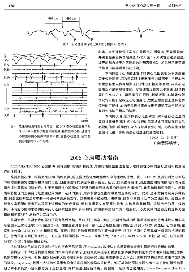 宽QRS波心动过速一例 机制分析.pdf_第2页