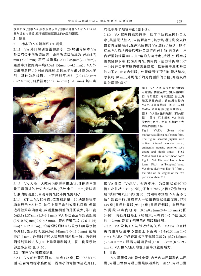 前庭导水管解剖与CT对照研究.pdf_第2页