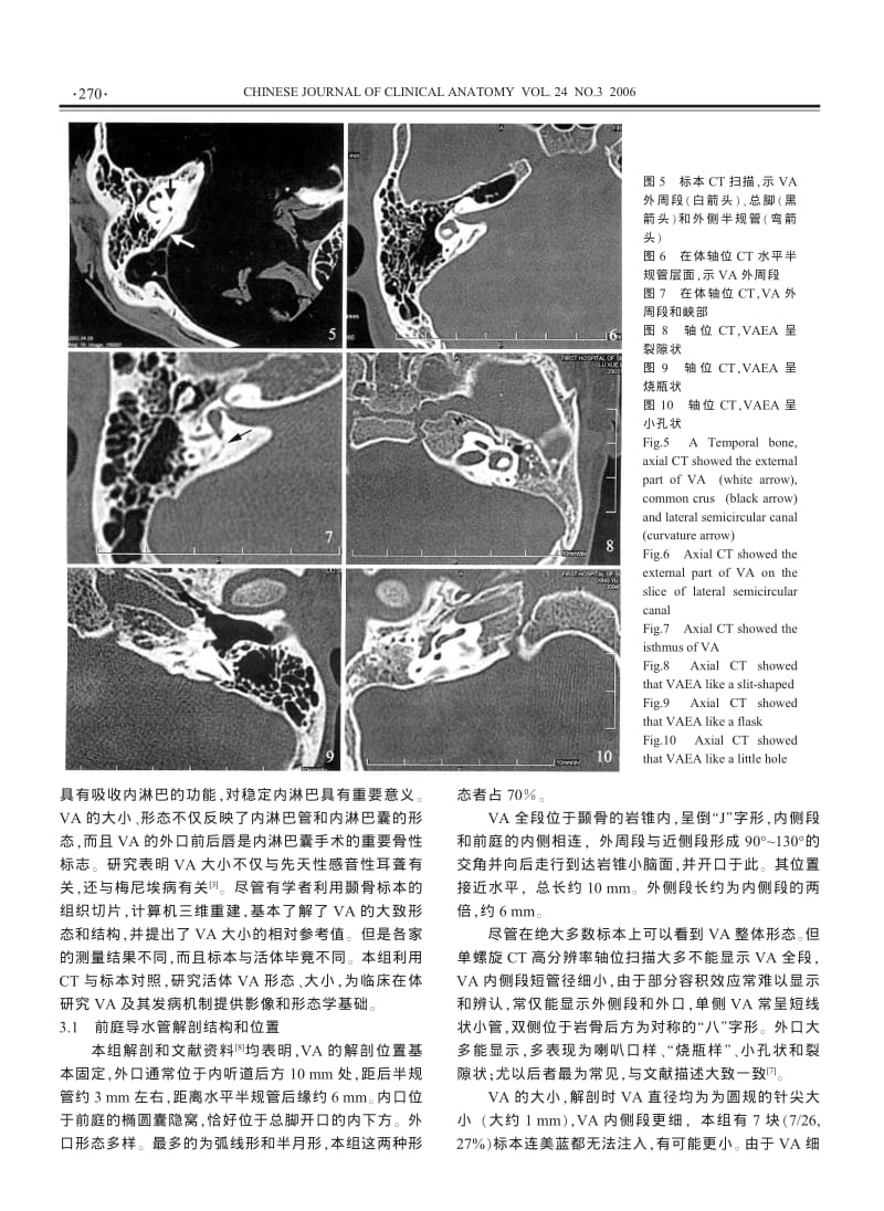 前庭导水管解剖与CT对照研究.pdf_第3页