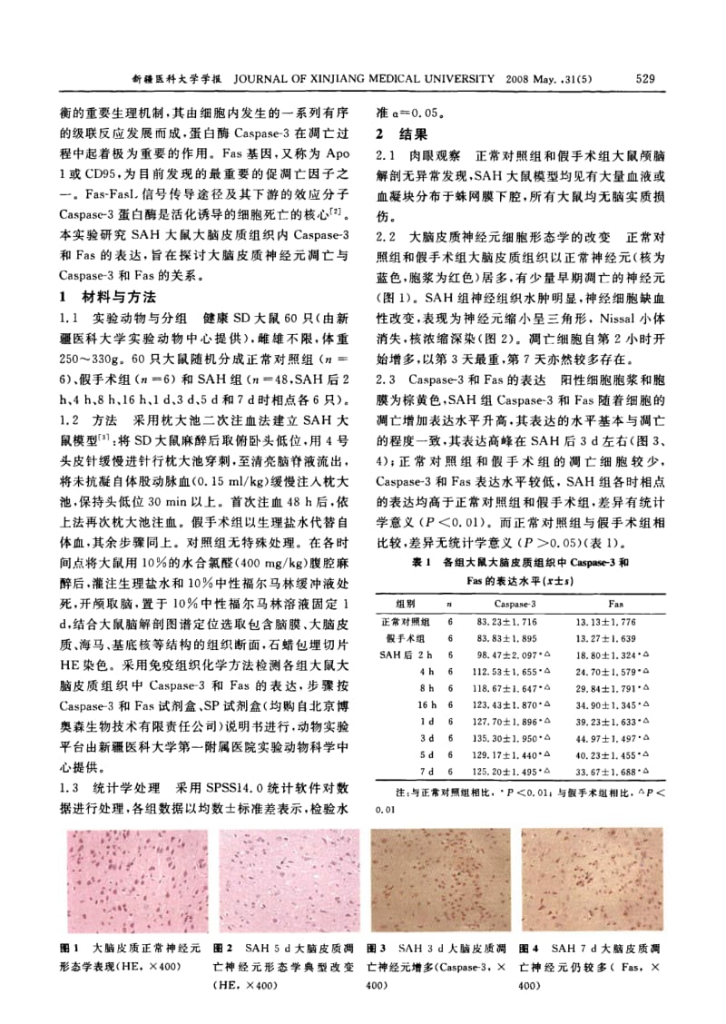 大鼠蛛网膜下腔出血后大脑皮质中神经元凋亡的研究.pdf_第2页