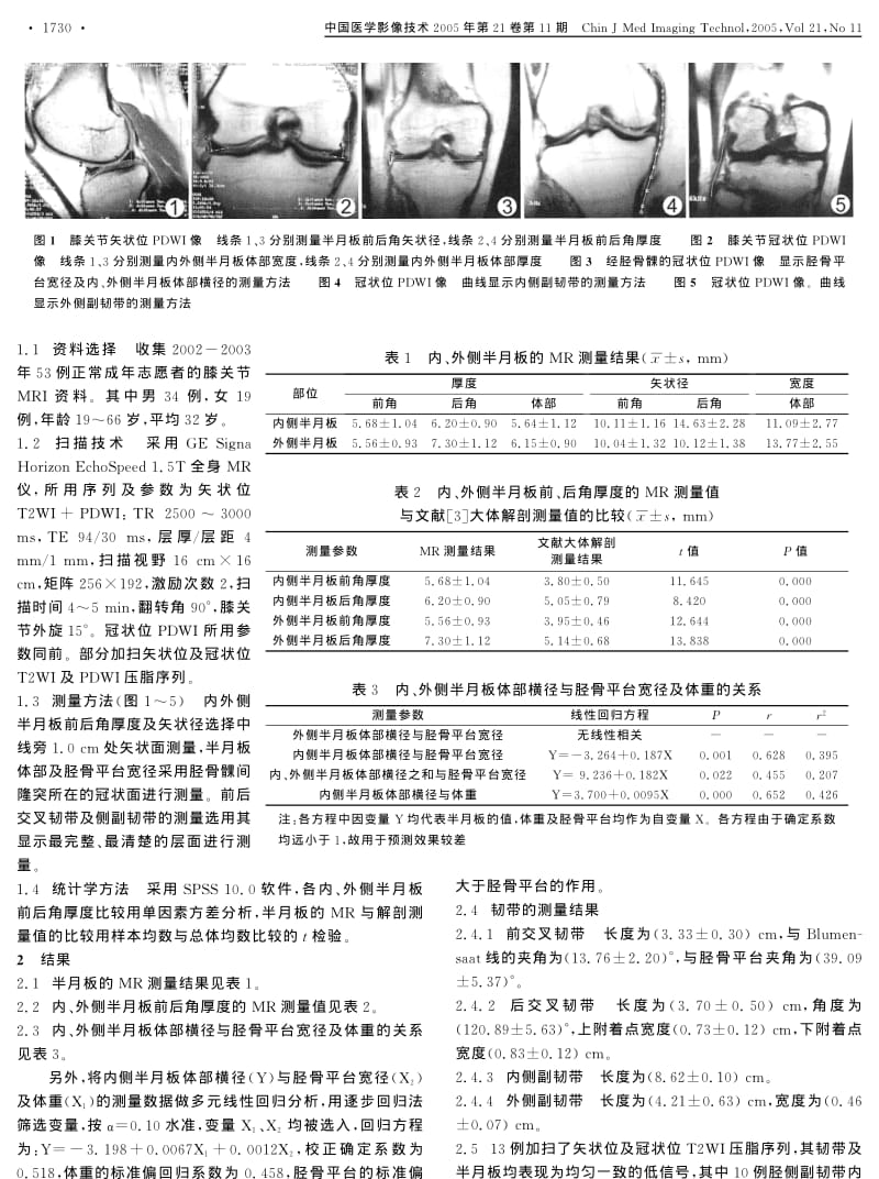 正常成年人膝关节的MR测量及其成像.pdf_第2页