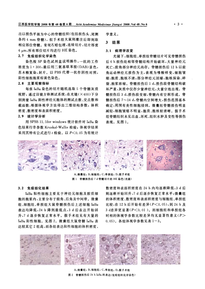 微囊化兔坐骨神经组织细胞移植对大鼠损伤脊髓后IκBa表达的影响及意义.pdf_第3页