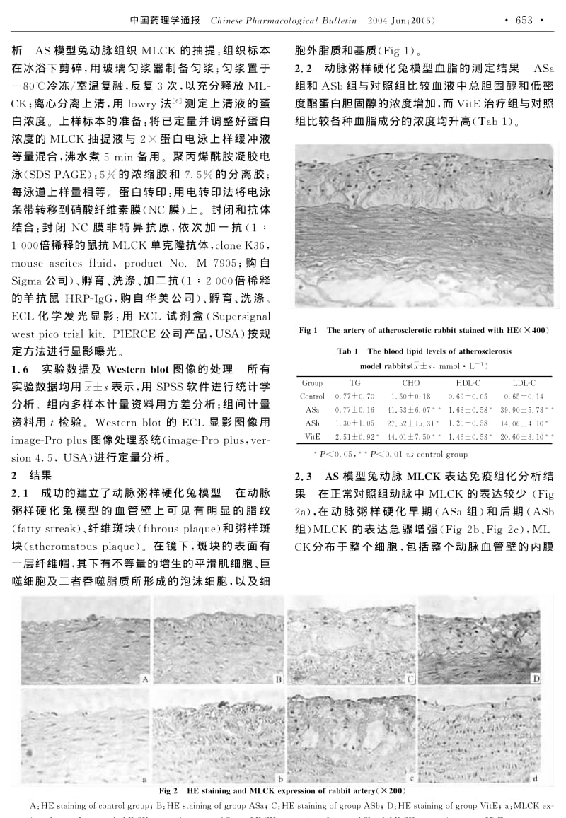 Vit E对动脉粥样硬化模型兔动脉肌球蛋白轻链激酶表达的影响.pdf_第2页