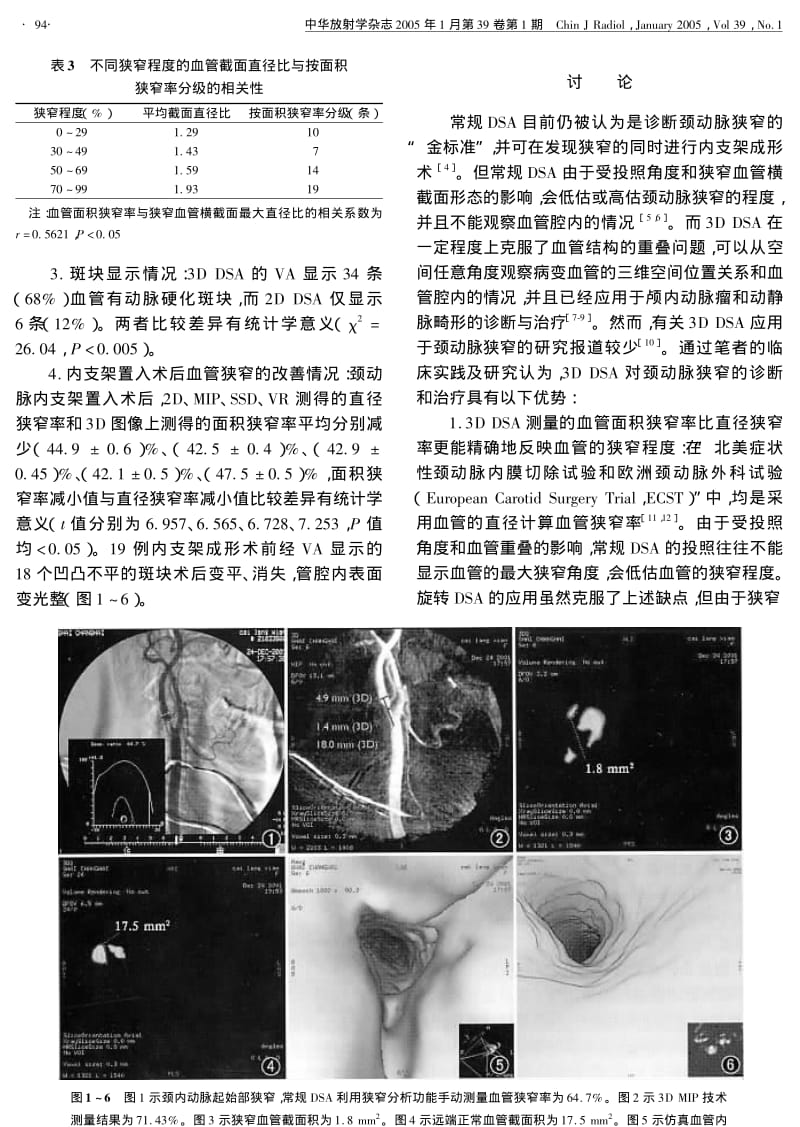 旋转DSA三维重建成像与常规DSA在颈动脉狭窄诊治中的比较研究.pdf_第3页