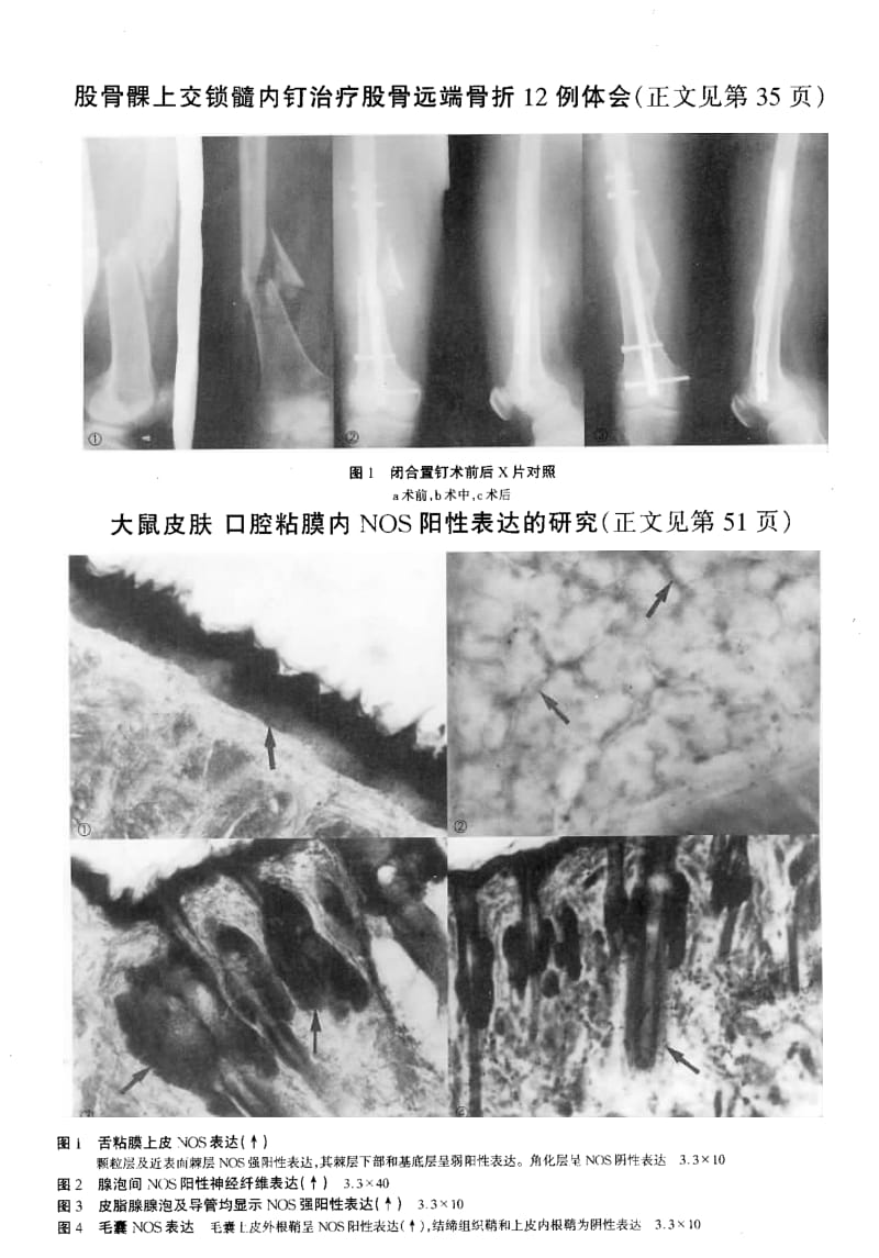 大鼠皮肤口腔粘膜内NOS阳性表达的研究.pdf_第3页