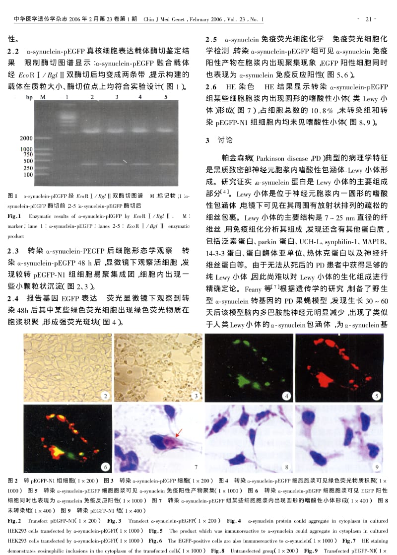 αSYNUCLEIN基因过度表达诱导HEK293细胞αSYNUCLEIN蛋白病理性积聚.pdf_第3页