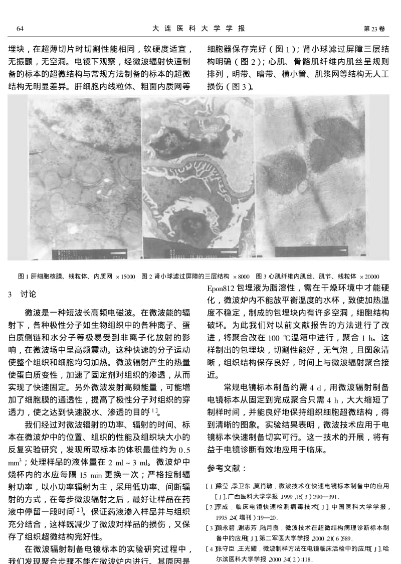 微波辐射快速制备电镜标本的实验研究.pdf_第2页